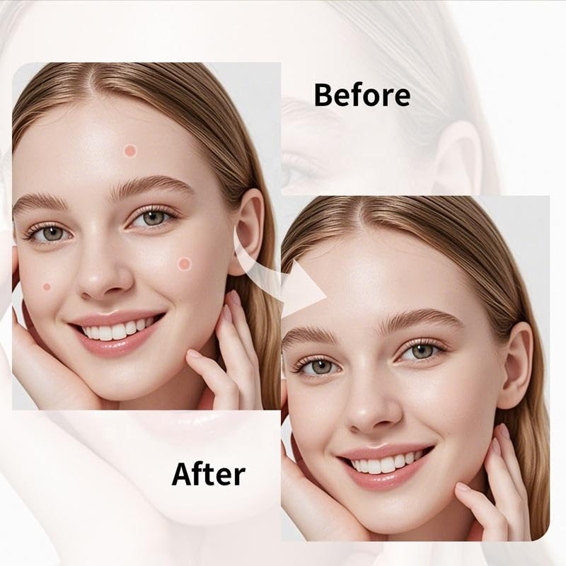 VelvetPore Hydrocolloid Acne Patches – Invisible Waterproof Pimple Patches for Face, Oil-Absorbing Zit Stickers, Strong Adhesion Blemish Spot Treatment, Day & Night Acne Cover, 72 Count (10mm & 12mm)
